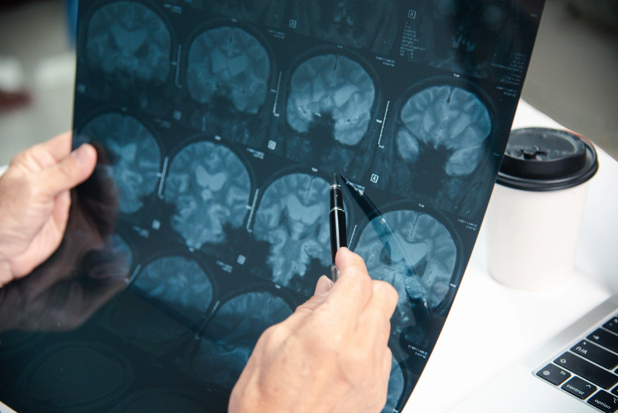 Traumatic Brain Inj Traumatic Brain Injury Treatment in Virginia Beach, VA | New Life Medical